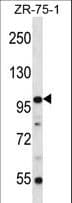 Polyclonal Rabbit anti-Human ZNF845 Antibody (aa72-100, WB)