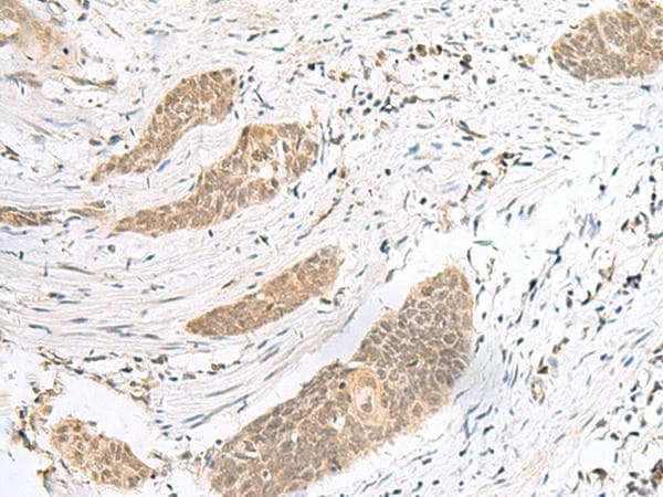 Polyclonal Rabbit anti-Human ENSA Antibody (IHC)