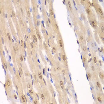 IHC-plus™ LIG3 / DNA Ligase III Antibody