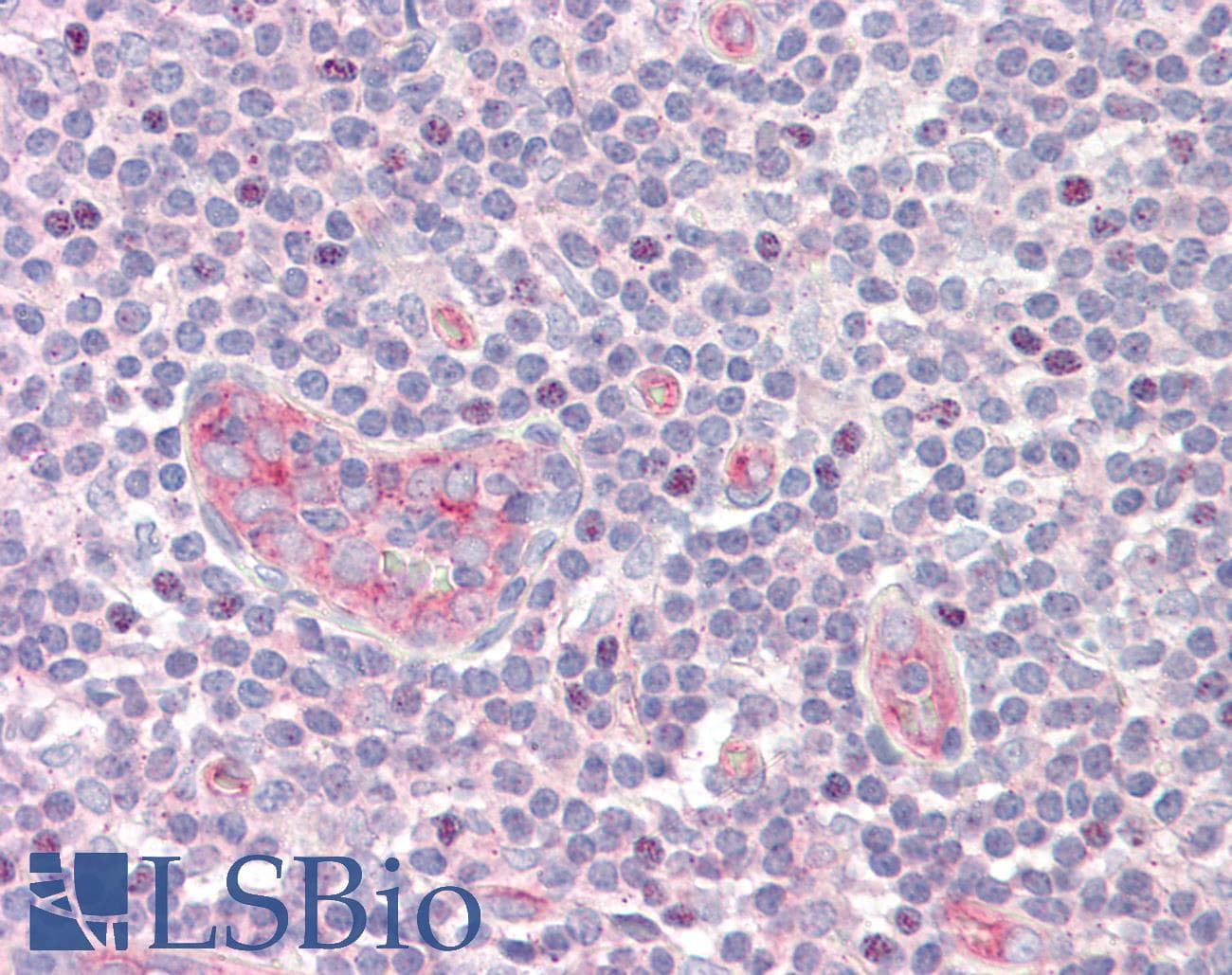 IHC-plus™ Polyclonal Rabbit anti-Human UBTF / UBF Antibody (aa501-550, IHC, WB)