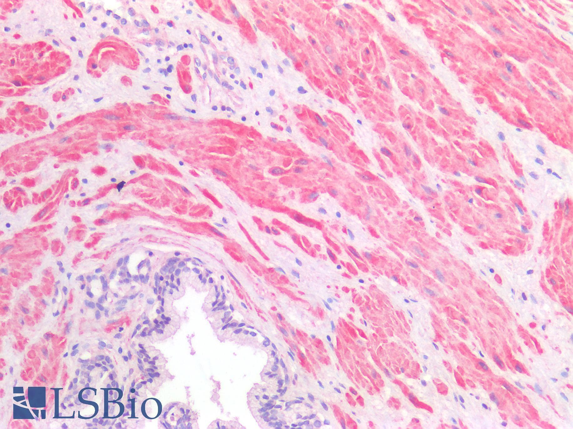 IHC-plus™ Polyclonal Rabbit anti-Human CD81 Antibody (IHC)