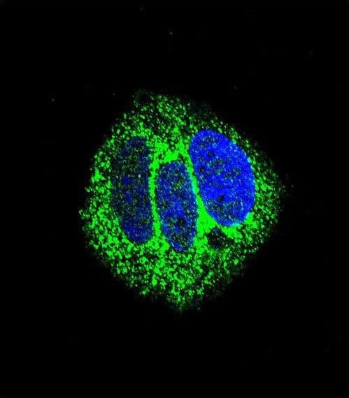 Polyclonal Rabbit anti-Human RARA / RAR Alpha Antibody (aa322-349, IHC, IF, WB)