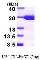 Human ARHGDIA / RHOGDI Protein (Recombinant His)