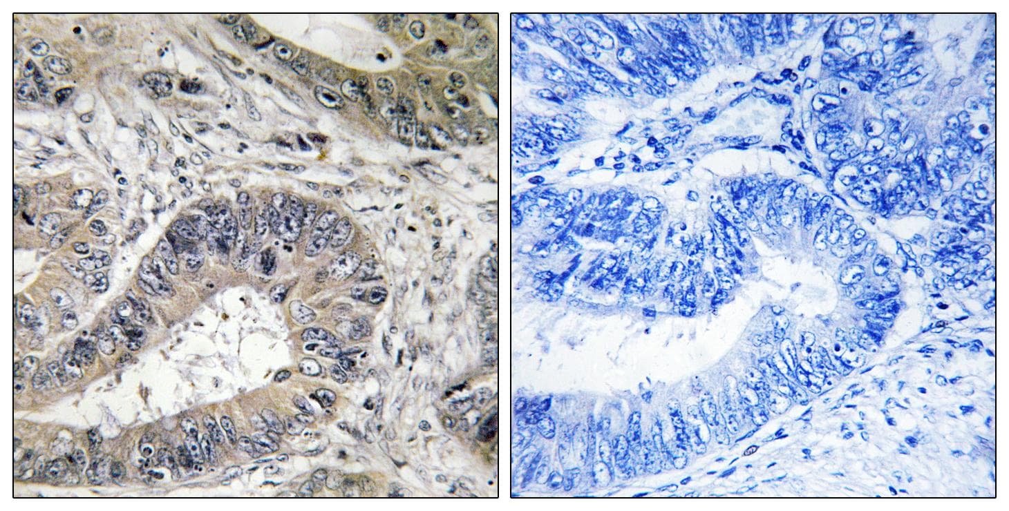 Polyclonal Rabbit anti-Human ERN2 Antibody (IHC, IF)