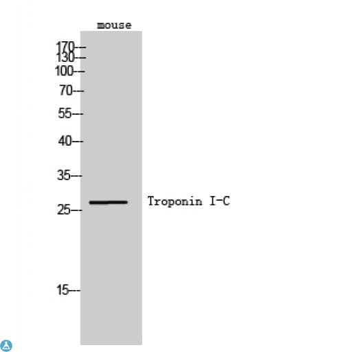 TNNI3 / Cardiac Troponin I Antibody