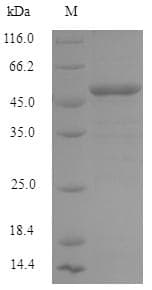 Human IFIH1 / MDA5 Protein (Recombinant 6His, N-terminus)