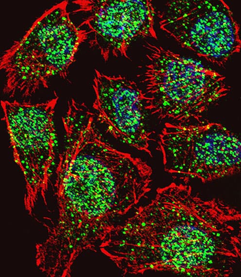 IHC-plus™ TSHZ2 Antibody (aa232-261)