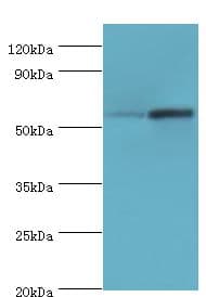 Polyclonal Rabbit anti-Human DFNA5 Antibody (aa1-260, IHC, WB)