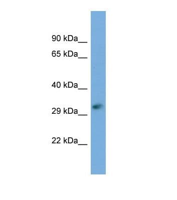 FKTN / Fukutin Antibody (aa214-263)