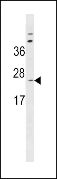 SPC18 / SEC11A Antibody (aa95-123)