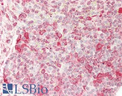 IHC-plus™ TUBB1 / Tubulin Beta 1 Antibody (clone 3F7)