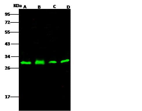 Polyclonal Rabbit anti-Human PHAP1 / ANP32A Antibody (Preservative Free, IHC, IF, WB)