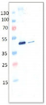 ADA / Adenosine Deaminase Antibody (clone 1F5-2G6)