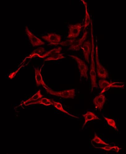 IL13RA2 / IL13R Alpha 2 Antibody