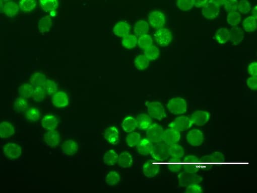 ERBB2 / HER2 Antibody (aa676-1255, clone UMAB35)