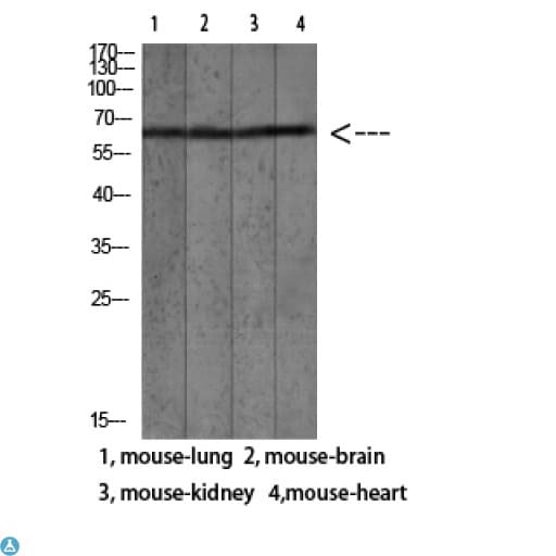MAC-2-BP / LGALS3BP Antibody