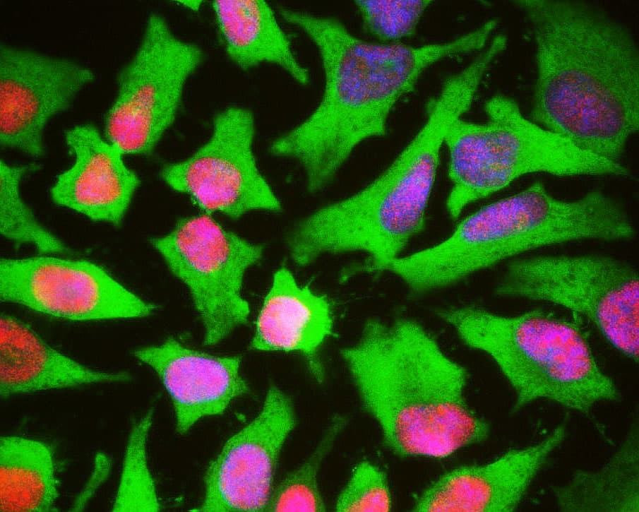 HSBP1 Antibody