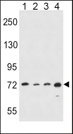ALOX15 / 15-Lipoxygenase Antibody (aa610-643)