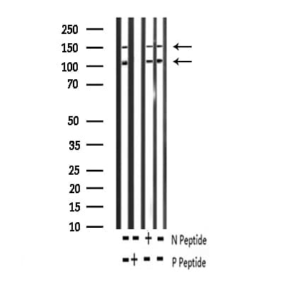 IGF1R / IGF1 Receptor Antibody (phospho-Tyr1161)