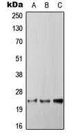 Polyclonal Rabbit anti-Human RGS4 Antibody (Internal, WB)