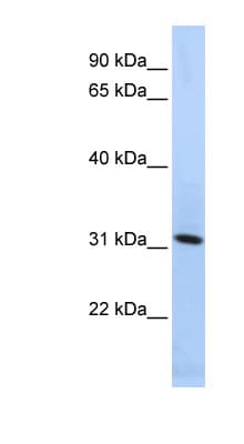 Polyclonal Rabbit anti-Human SYNGR4 / Synaptogyrin 4 Antibody (N-Terminus, WB)
