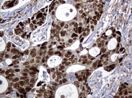 TP53 / p53 Antibody (clone UMAB62, Carrier-free)