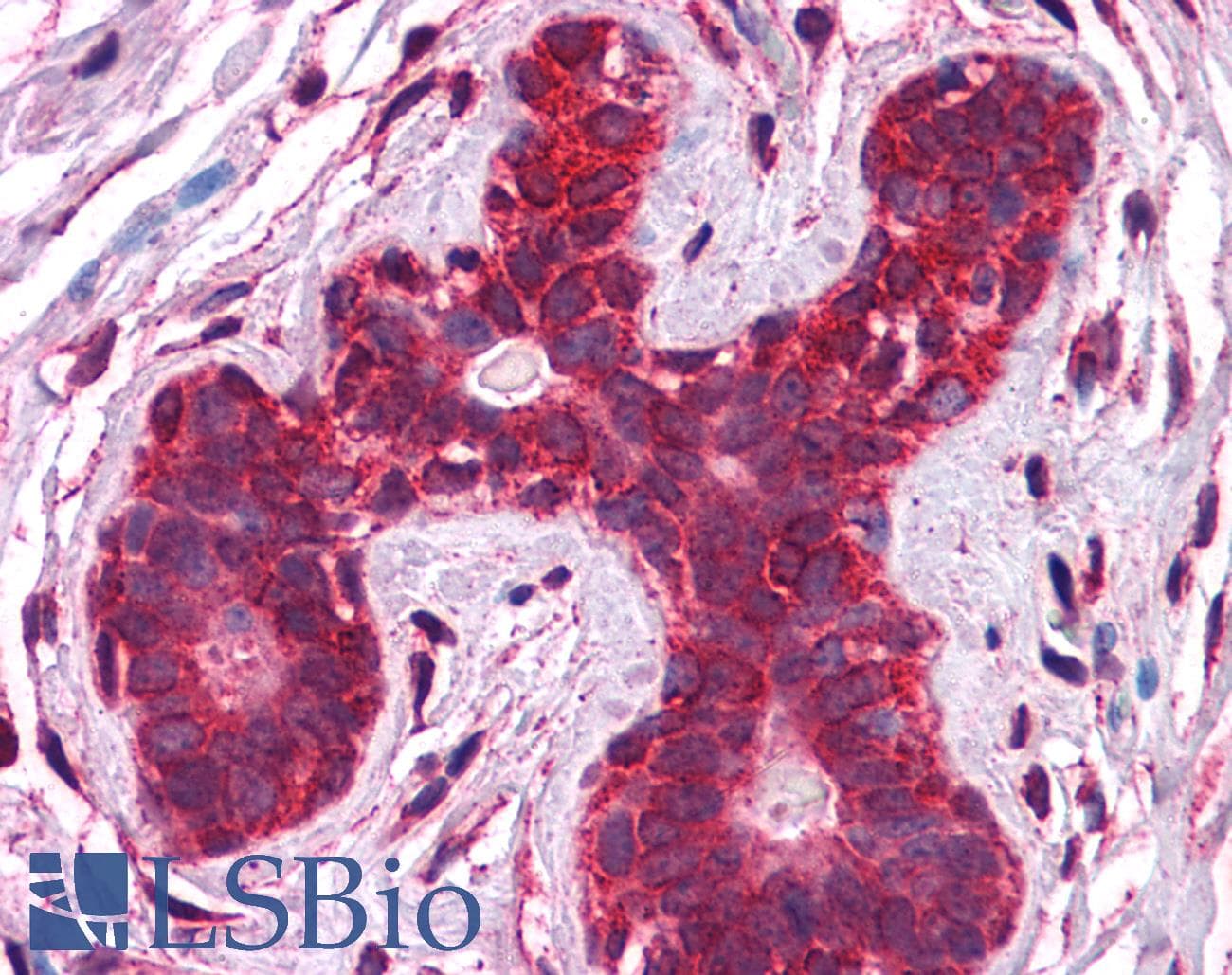 Polyclonal Rabbit anti-Human CALR / Calreticulin Antibody (aa342-391, IHC, WB)
