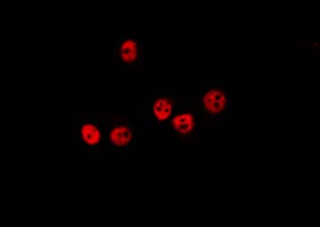 Polyclonal Rabbit anti-Human PPP1CA / PP1-Alpha Antibody (IHC, WB)