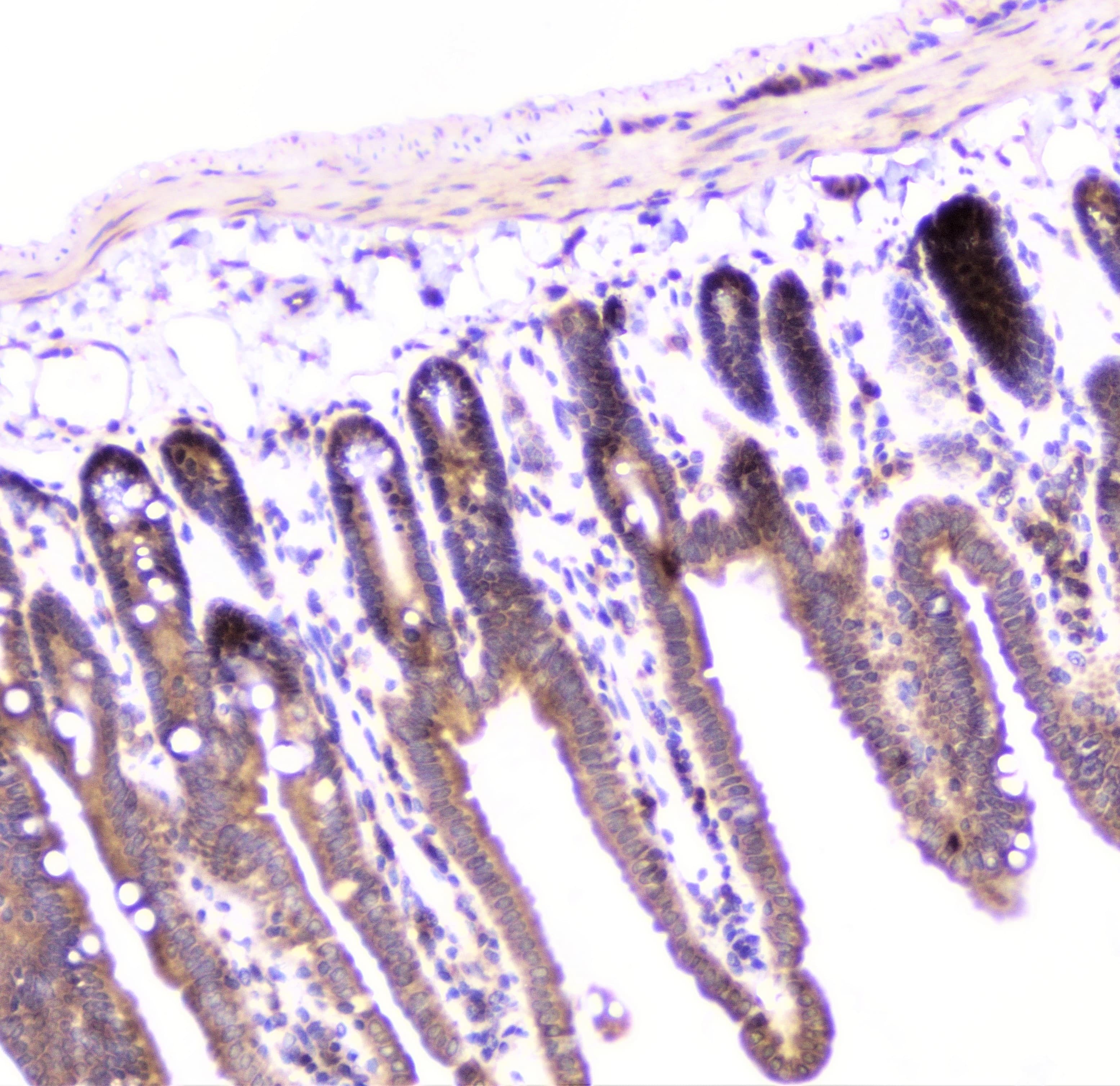 UBE2I / UBC9 Antibody