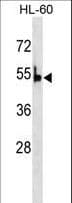 PKLR Antibody (aa521-551)