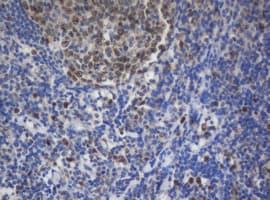 Monoclonal Mouse anti-Human MKI67 / Ki67 Antibody (clone OTI8H5, IHC)