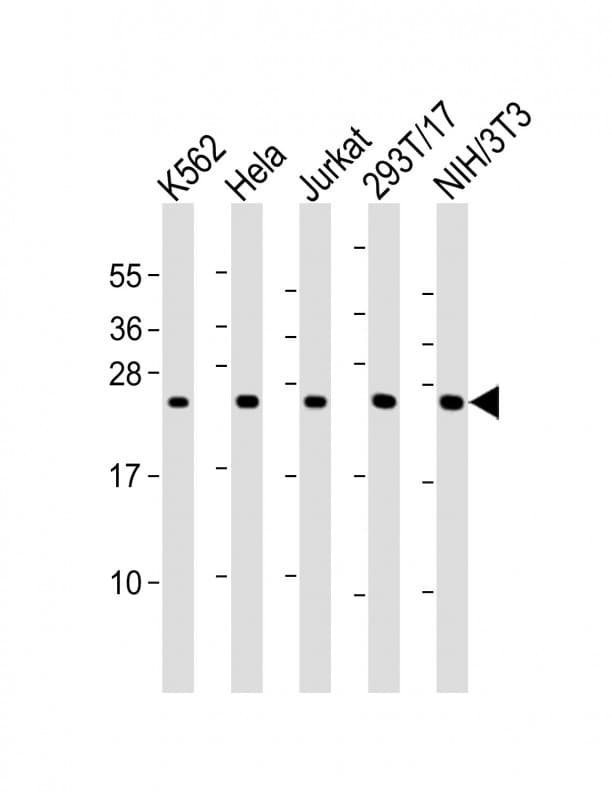 Polyclonal Rabbit anti-Human PSMB3 Antibody (aa150-185, WB)