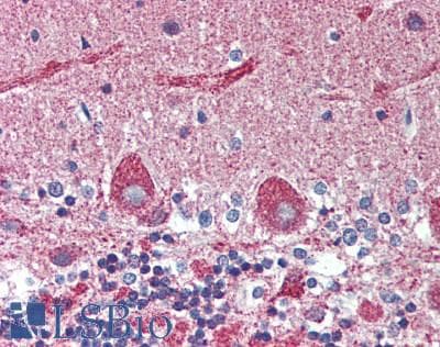 IHC-plus™ Polyclonal Rabbit anti-Human SKI Antibody (aa678-728, IHC, WB)