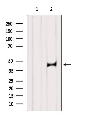ST8SIA2 / STX Antibody