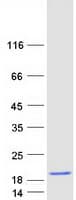 Human HBG2 / Hemoglobin Gamma 2 Protein (Recombinant Myc-DDK (Flag))