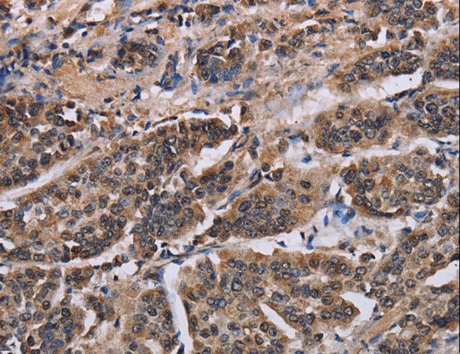 KIF2A Antibody