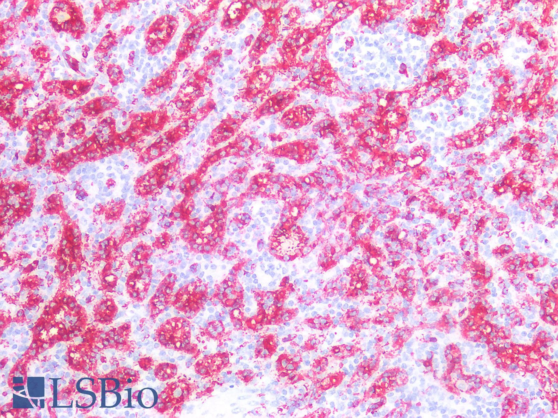 IHC-plus™ Blood Group A Antibody (clone B480)