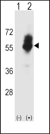SLC7A1 / CAT1 Antibody (aa429-457)