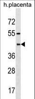 PSG6 Antibody (aa22-48)