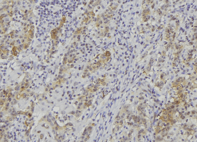 ADAMTS14 Antibody