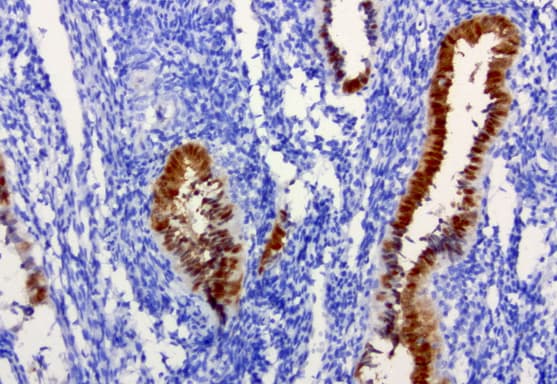 IRF6 Antibody (clone UMAB106, Carrier-free)