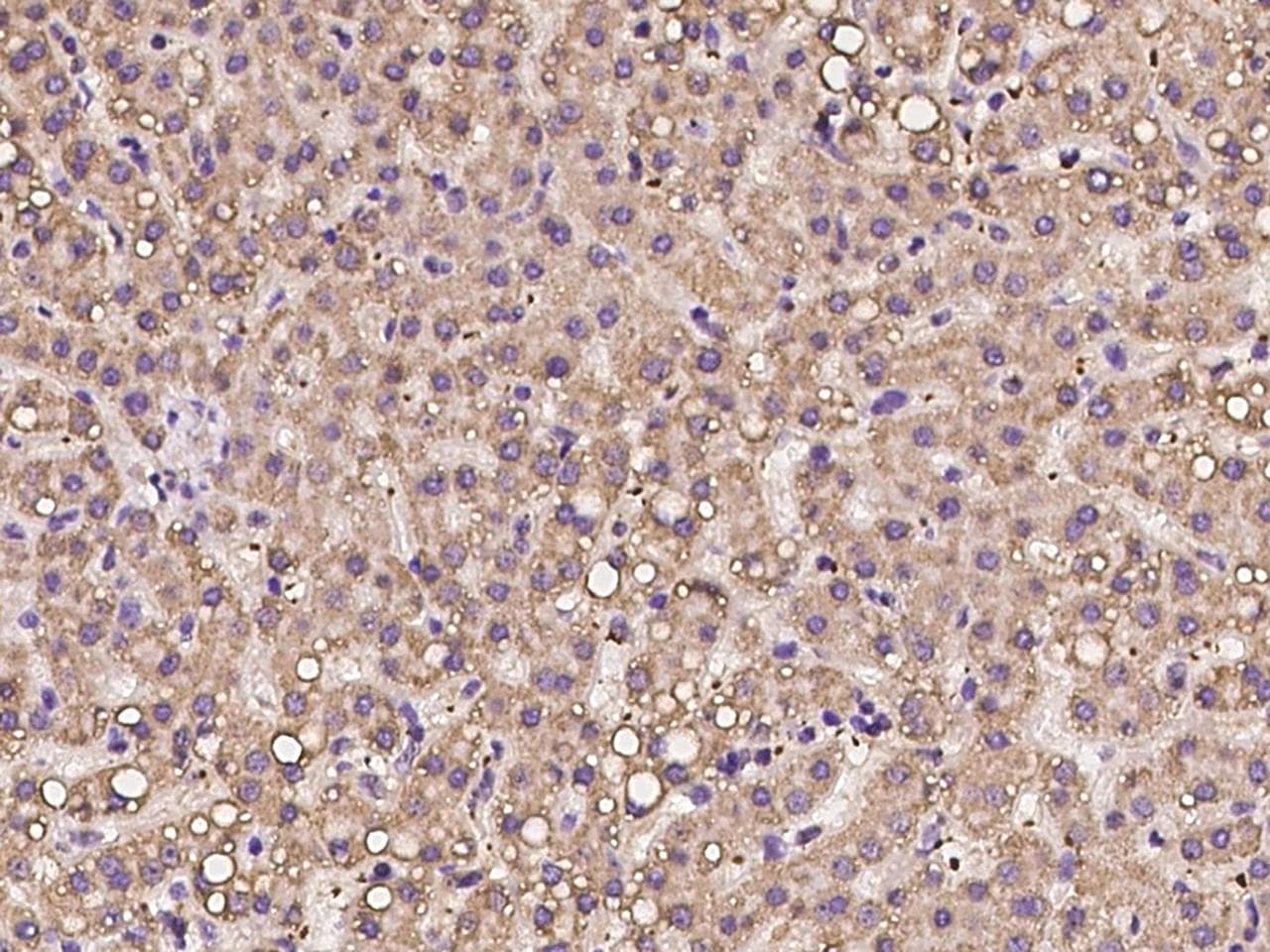 PLEK / Pleckstrin Antibody