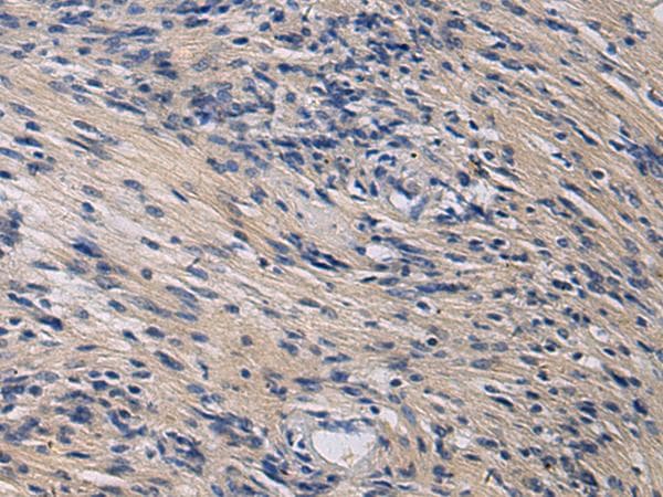 EKLF / KLF1 Antibody