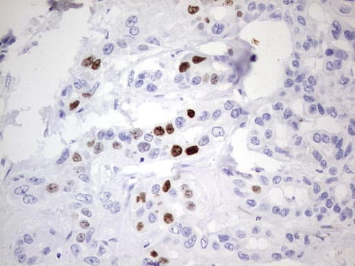 MKI67 / Ki67 Antibody (aa1160-1493, clone OTI8G3)