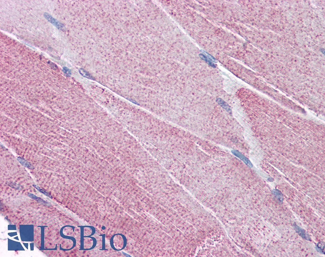 IHC-plus™ PACE4 / PCSK6 Antibody (aa637-648)
