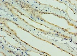 PARL / PSARL Antibody (aa1-170)