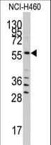 SARS / Serine-tRNA Ligase Antibody (aa394-422)