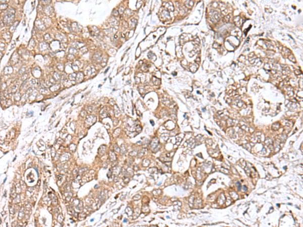 Polyclonal Rabbit anti-Human TEAD2 Antibody (IHC)