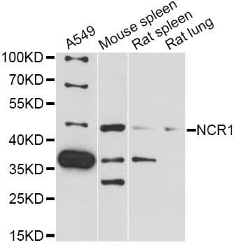 Polyclonal Rabbit anti-Human NCR1 / NKP46 Antibody (WB)