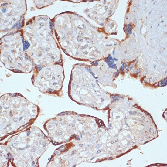 PDGFRB / PDGFR Beta Antibody